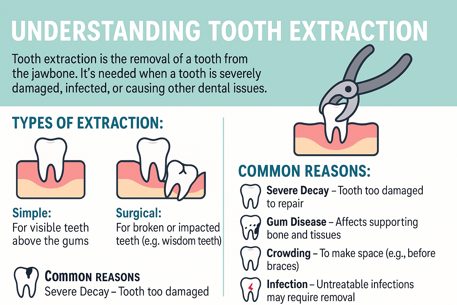 Understanding Tooth Extraction
